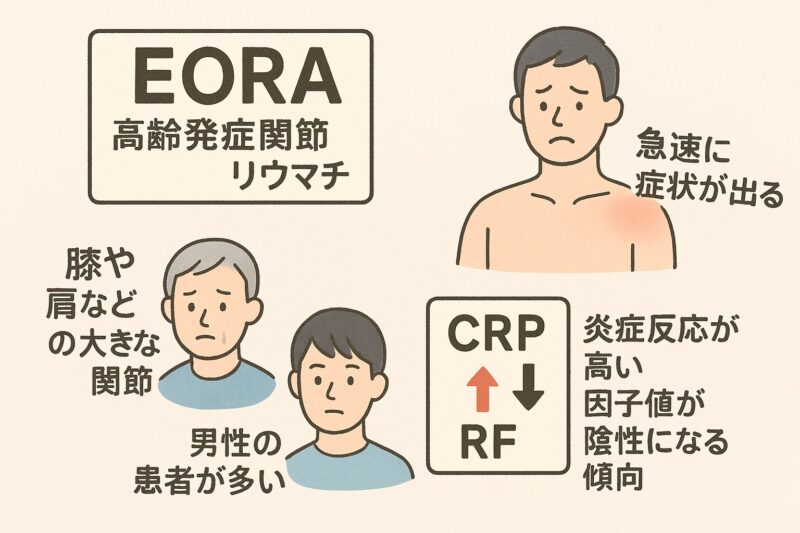 60歳以上に発症する関節リウマチ(EORA:Elderly-onset Rheumatoid Arthritis)についての解説のアイキャッチ画像
