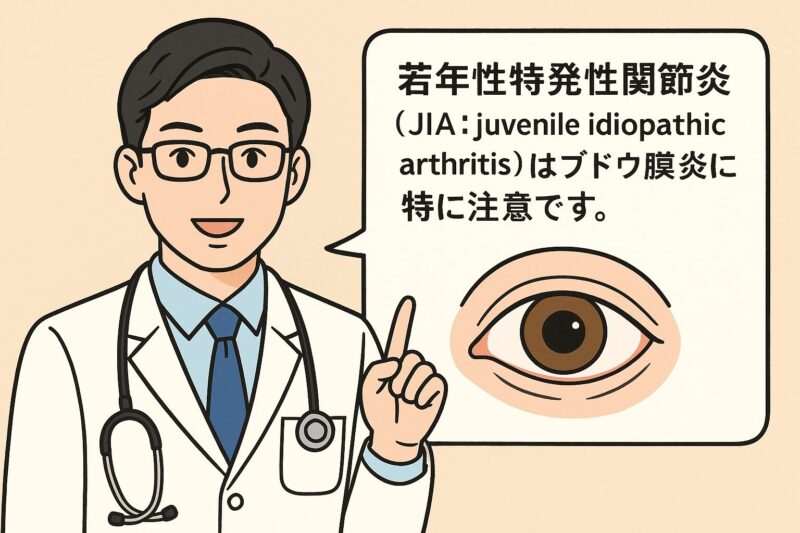 若年性特発性関節炎（JIA：juvenile idiopathic arthritis）はブドウ膜炎に特に注意です。のアイキャッチ画像
