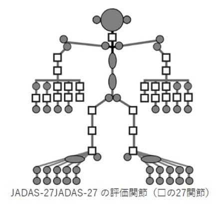 関節型若年性特発性関節炎（JIA）患者さんの成人移行期における疾患活動性評価はDAS28よりもJADAS27の方が正確です。のアイキャッチ画像