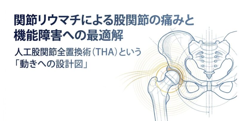関節リウマチによる股関節の痛み・破壊への人工股関節全置換術（THA）：痛みの解消と歩行機能の再建【柏・我孫子のリウマチ専門外来】のアイキャッチ画像