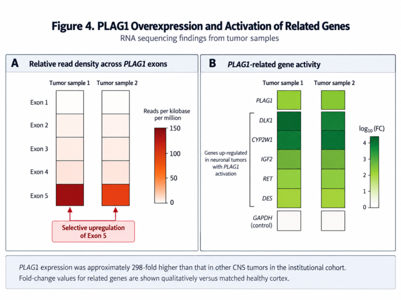 AAV組込み後のPLAG1エクソン5発現亢進とIGF2など5つの腫瘍関連遺伝子の発現上昇