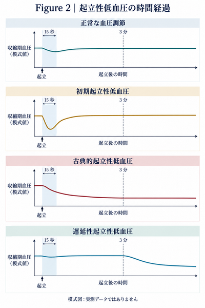 起立直後、3分以内、3分を超えた時点で生じる起立性低血圧の違いを示す血圧推移グラフ。