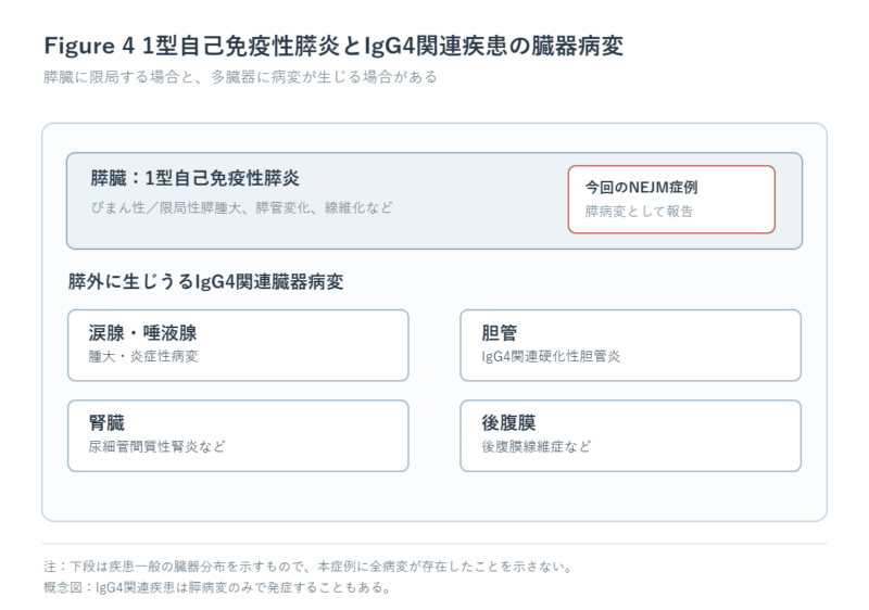 全身の臓器模式図に、IgG4関連疾患が生じうる膵臓、胆管、涙腺・唾液腺、腎臓、後腹膜を表示。