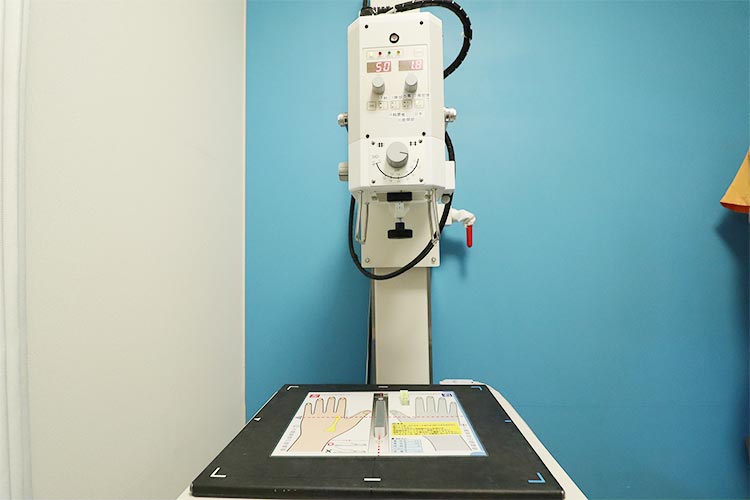 骨密度測定のポータブルX装置